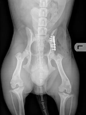 osteosynthese na operatie