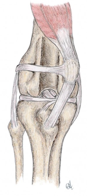 Patella luxatie